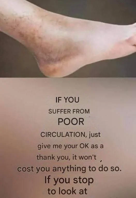 How to Improve Leg Circulation